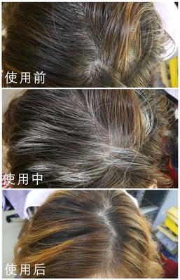 美國甜心傾心推薦，高科技頭發護理 告別煩惱，擁抱健康秀發